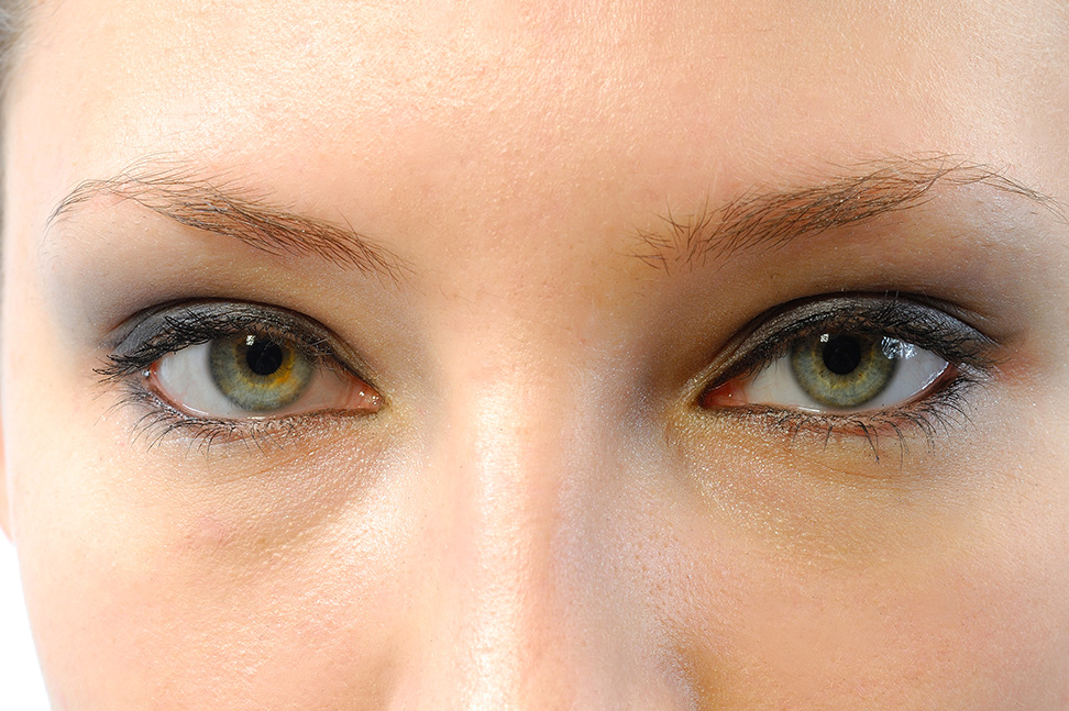 Traitement rides autour des yeux : quelles solutions pour lisser le regard ?